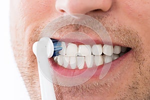 Man Teeth With Electric Toothbrush photo