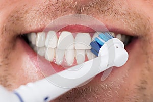 Man Teeth With Electric Toothbrush photo