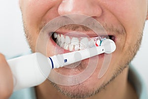 Man Teeth With Electric Toothbrush photo