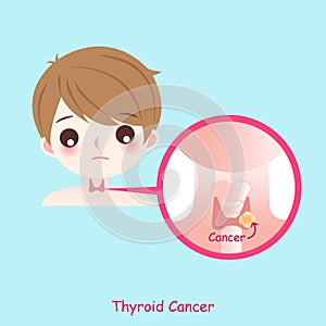 Man with thyroid cancer