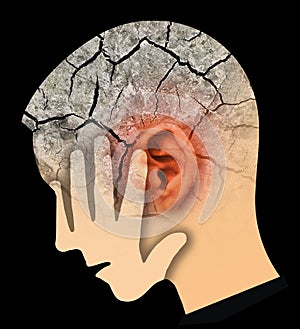 Man touching her painful head and ear, symbolizing tinnitus and ear problems. photo
