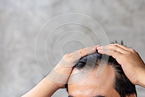 Man touching his head to show bald head or Glabrous problem. Copy space with grey background