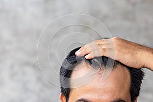 Man touching his head to show bald head or Glabrous problem. Copy space with grey background