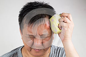 Man treating his injured painful swollen forehead bump with icepack