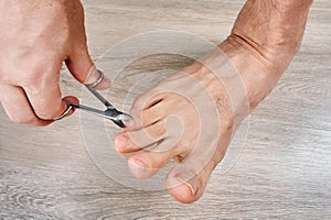 Man trims his toenails using toe nail scissors.