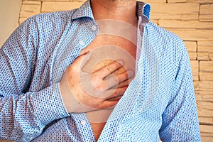 Man unbuttoned his shirt on his chest and placed his hand on sternum area because of severe pain behind his sternum or chest. Conc photo