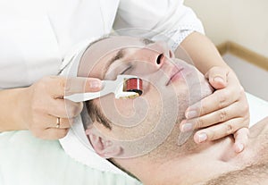 Man undergoes the procedure of medical micro needle therapy with a modern medical instrument derma roller.