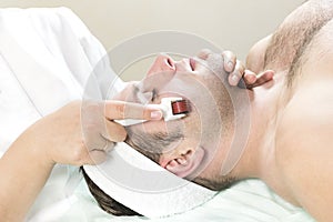 Man undergoes the procedure of medical micro needle therapy with a modern medical instrument derma roller.