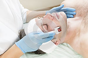 Man undergoes the procedure of medical micro needle therapy with a modern medical instrument derma roller. photo