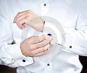 Man wears cuff-links on a shirt sleeve. A groom putting on cuff-links as he gets dressed in formal wear. Groom's suit