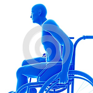 Man in a wheel chair