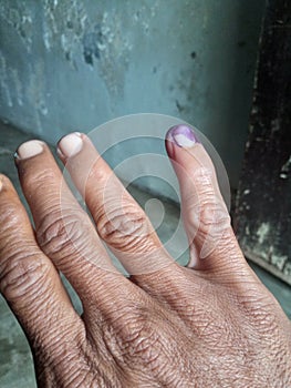 a man& x27;s palm with his little finger inked as a sign that he has participated in the general election in Indonesia photo