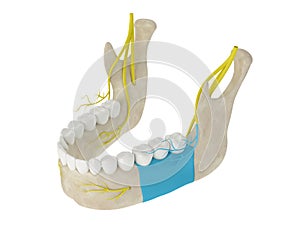 Mandibular arch with buccal nerve block photo