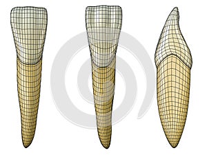 Mandibular central incisor tooth in the vestibular, palatal and lateral views with black wireframe wrapping the tooth.