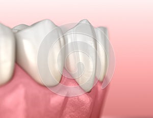 Mandibular human gum and teeth anatomy. Medically accurate tooth illustration