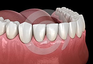 Mandibular human gum and teeth. Medically accurate tooth illustration