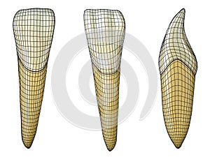 Mandibular lateral incisor tooth in the vestibular, palatal and lateral views with black wireframe wrapping the tooth