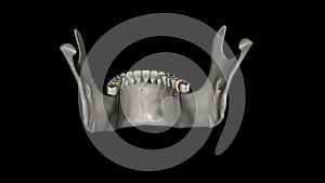The mandibular second molar resembles the mandibular first permanent molar