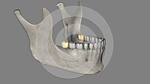 The mandibular third molar is also referred as the wisdom tooth