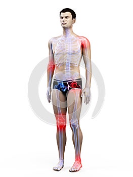 A mans painful joints