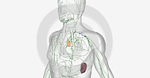 Mantle cell lymphoma in Lymph node photo