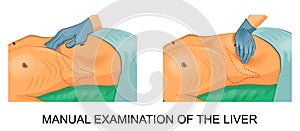 Manual examination of the liver