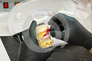 Manufacturing of dentures