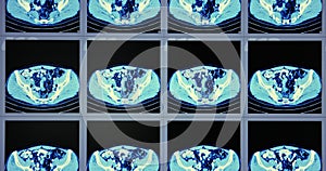 Many computed tomography scans in motion of lower and middle abdominal area