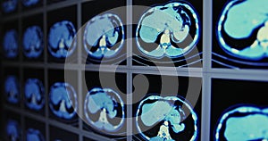 Many computed tomography scans in motion of lower and middle abdominal area