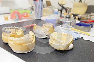 many dental prosthesis molds on technician& x27;s desk