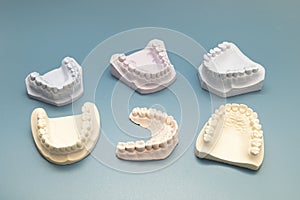 Many Die Stone, Plaster Cast Molds Of The Upper And Lower Jaws And Teeth With A Pliable
