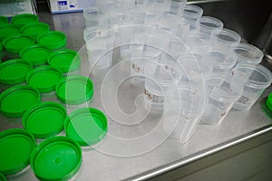 many preparation pots were opened to fill them with formalin