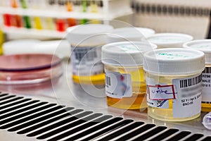 Many urine samples in an asceptic container for laboratory pathological biochemical microbiological and cytological analysis