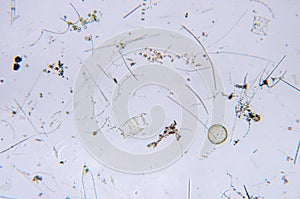 Marine aquatic plankton under microscope view