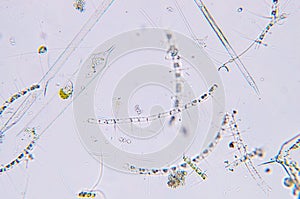 Marine aquatic plankton under microscope view