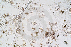 Marine aquatic plankton under the microscope view