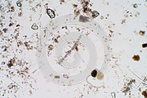 Marine aquatic plankton under the microscope view.