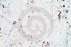 Marine aquatic plankton under microscope view