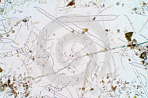 Marine aquatic plankton under microscope view