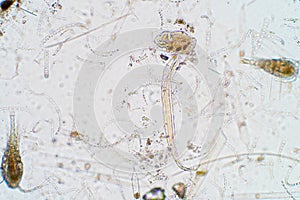 Marine aquatic plankton under microscope view