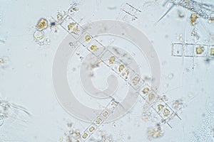 Marine aquatic plankton under microscope view