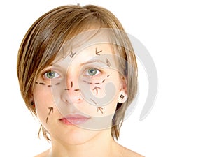 Marked face for plastic surgery