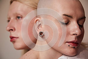 Masculine woman and womanly albino guy with feminine features