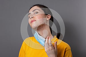 Maskne. A young Caucasian woman takes off her protective mask and shows pimples on her chin. Gray background. The concept of acne