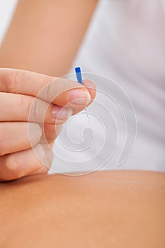 Masseuse holding needle