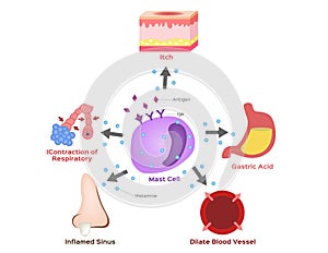 Mast cell vector / histamine / allergy