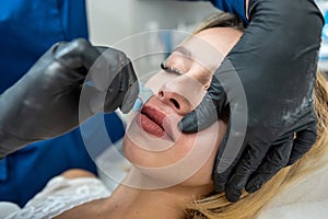 master applying cosmetics gel wax upper lip before hair removal procedure in clinic