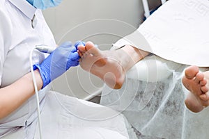 Master chiropody shapes the nails . Male patient in the process of hardware pedicure procedure. Concept body care. Close up, selec photo