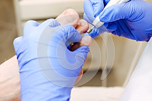 Master chiropody shapes the nails . Male patient in the process of hardware pedicure procedure. Concept body care. Close up, selec photo