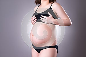 Mastitis during pregnancy, breast pain, swelling of mammary glands photo